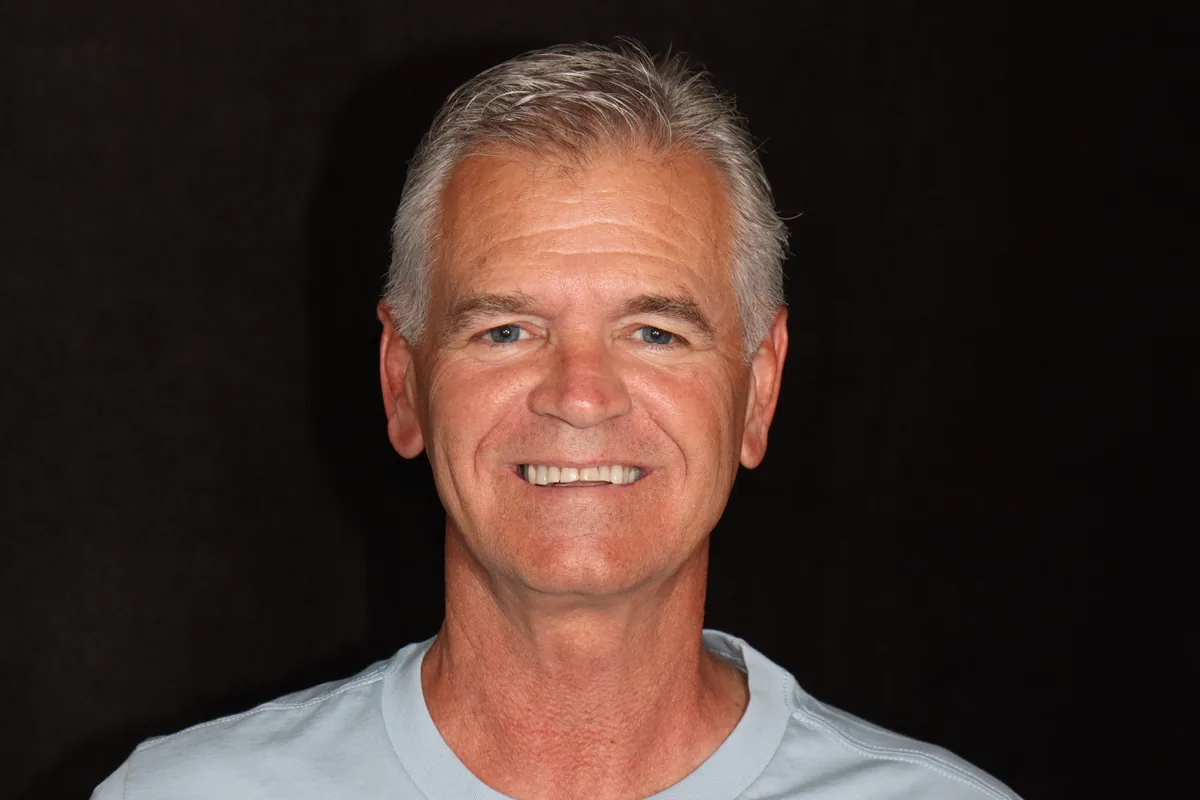 Before — Kelly — Smile Makeover